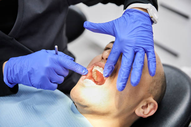 Best Emergency Dental Extractions in Centreville, AL