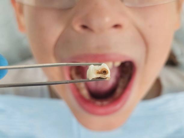 Best Emergency Dental Services for Seniors in Centreville, AL